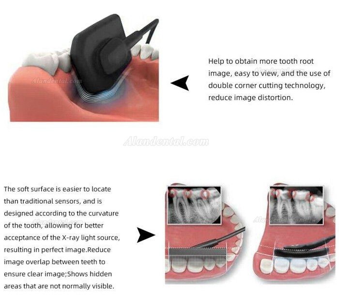 Dental Digital Image RVG X-Ray Sensor Dental Intraoral Imaging System